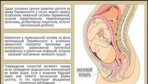 Почему тянет живот на 18 неделе беременности