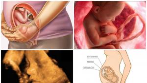 semaines de grossesse, le ventre se transforme en pierre - cela signifie bientôt à la maternité