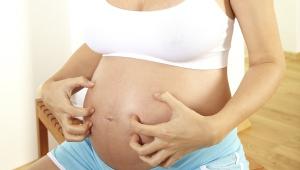 Зуд при беременности: почему чешется тело во время беременности